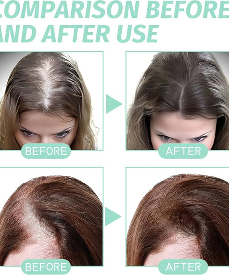 Bunee Pure Organic Biotin Rosemary Oil (60ml)