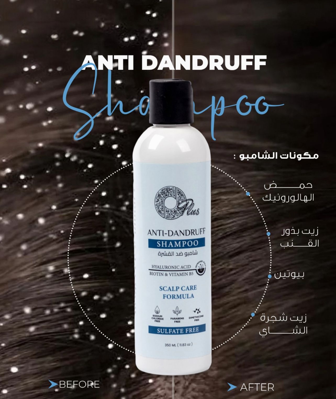 ANTI-DANDRUFF SHAMPOO - HYALURONIC ACID - BIOTIN & VITAMIN B5(350ml)