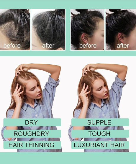 Bunee Pure Organic Biotin Rosemary Oil (60ml)